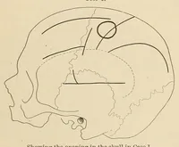 An illustration from The American journal of the medical sciences (1827)