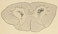 An illustration from The American journal of the medical sciences (1827)