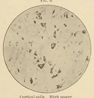 Picture 9 of 9 from The American journal of the medical sciences (1827), leaf 903