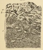 An illustration from The American journal of the medical sciences (1827)