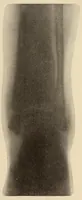 An illustration from The American journal of the medical sciences (1827)