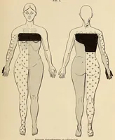 An illustration from The American journal of the medical sciences (1827)