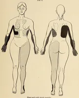 An illustration from The American journal of the medical sciences (1827)