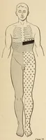 An illustration from The American journal of the medical sciences (1827)