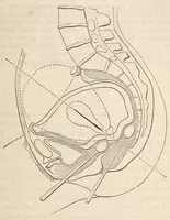 An illustration from The American journal of the medical sciences (1827)