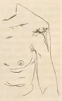An illustration from The American journal of the medical sciences (1827)
