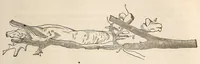 An illustration from The American journal of the medical sciences (1827)