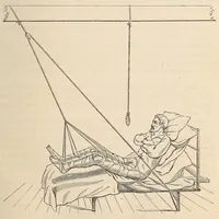 An illustration from The American journal of the medical sciences (1827)