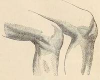 An illustration from The American journal of the medical sciences (1827)