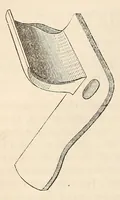 An illustration from The American journal of the medical sciences (1827)
