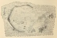 An illustration from The American journal of the medical sciences (1827)