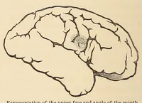 An illustration from The American journal of the medical sciences (1827)
