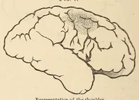 An illustration from The American journal of the medical sciences (1827)