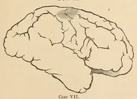An illustration from The American journal of the medical sciences (1827)