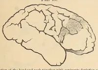 An illustration from The American journal of the medical sciences (1827)