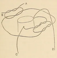 An illustration from The American journal of the medical sciences (1827)