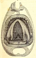 An illustration from The American journal of the medical sciences (1827)