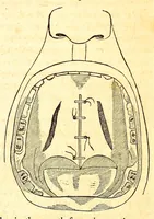 An illustration from The American journal of the medical sciences (1827)