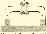 An illustration from The American journal of the medical sciences (1827)