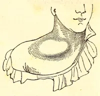 Picture 1 of 5 from The American journal of the medical sciences (1827), leaf 19