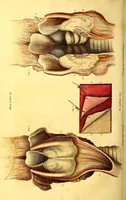 An illustration from The American journal of the medical sciences (1827)