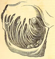 An illustration from The American journal of the medical sciences (1827)