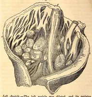 An illustration from The American journal of the medical sciences (1827)
