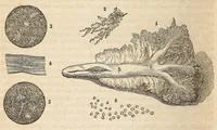 An illustration from The American journal of the medical sciences (1827)