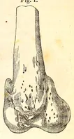 An illustration from The American journal of the medical sciences (1827)