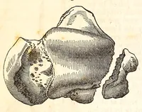 An illustration from The American journal of the medical sciences (1827)