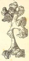 Picture 4 of 8 from The American journal of the medical sciences (1827), leaf 129