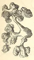 An illustration from The American journal of the medical sciences (1827)