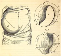 Picture 7 of 8 from The American journal of the medical sciences (1827), leaf 356
