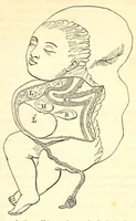 An illustration from The American journal of the medical sciences (1827)