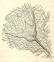 Picture 5 of 13 from The American journal of the medical sciences (1827), leaf 100