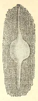 An illustration from The American journal of the medical sciences (1827)
