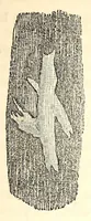 Picture 8 of 13 from The American journal of the medical sciences (1827), leaf 101