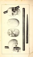 Picture 2 of 13 from The American journal of the medical sciences (1827), leaf 22