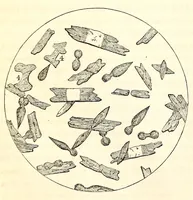 An illustration from The American journal of the medical sciences (1827)
