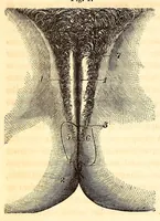 An illustration from The American journal of the medical sciences (1827)