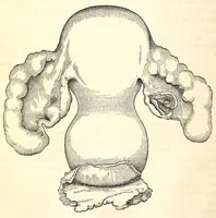 An illustration from The American journal of the medical sciences (1827)