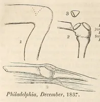 Picture 7 of 9 from The American journal of the medical sciences (1827), leaf 344