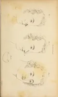 Picture 1 of 10 from The American journal of the medical sciences (1827), leaf 19