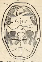 Picture 9 of 10 from The American journal of the medical sciences (1827), leaf 398