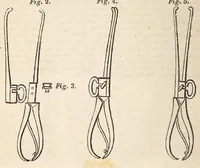 An illustration from The American journal of the medical sciences (1827)