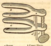 An illustration from The American journal of the medical sciences (1827)