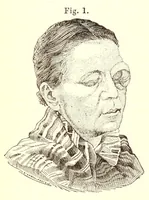 An illustration from The American journal of the medical sciences (1827)