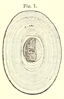 An illustration from The American journal of the medical sciences (1827)