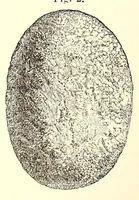 An illustration from The American journal of the medical sciences (1827)