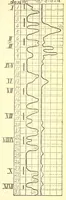 An illustration from The American journal of the medical sciences (1827)